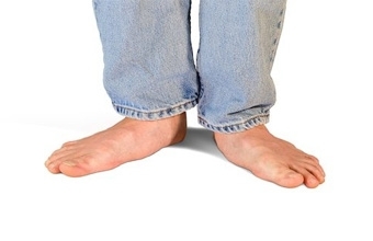 Flatfeet in Adults