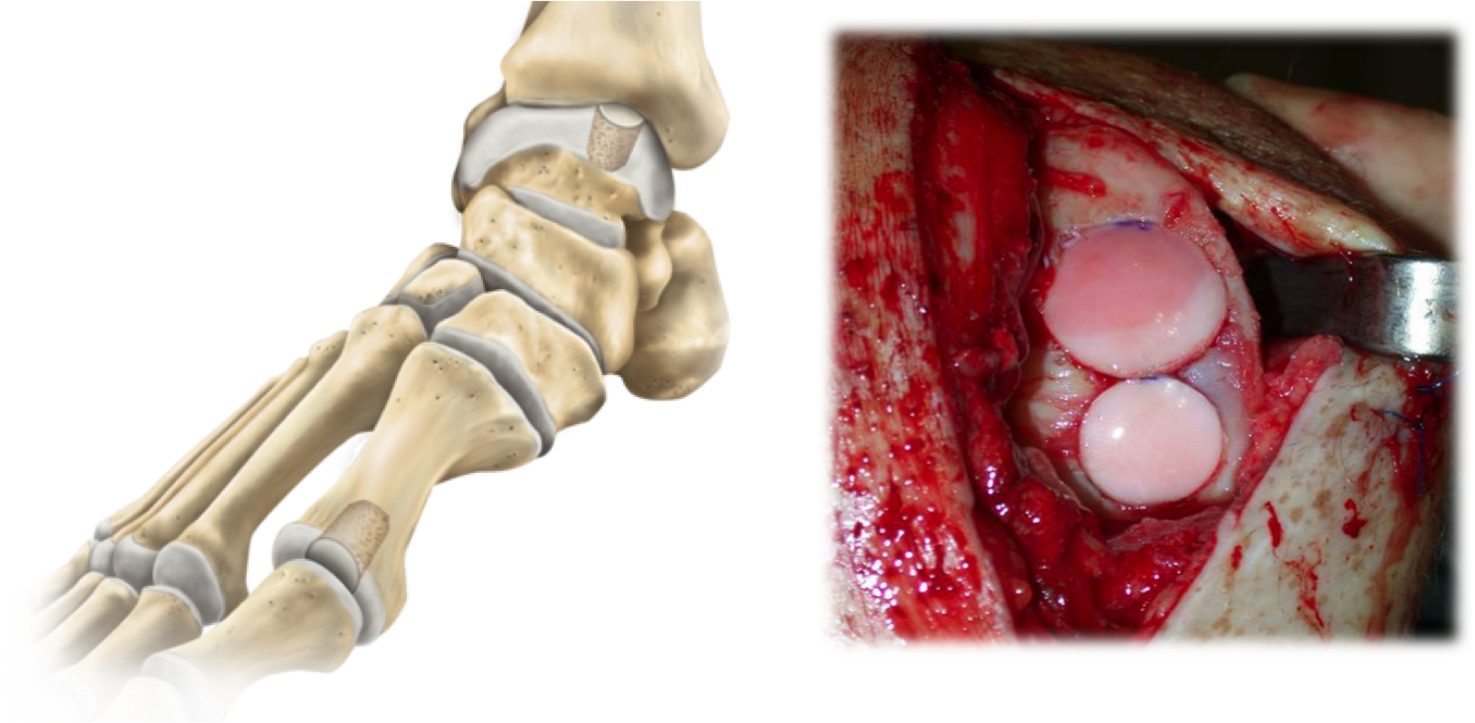 Arthritis3
