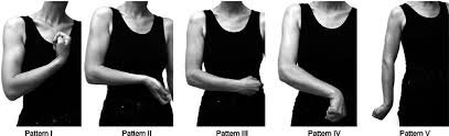 Stroke Arms