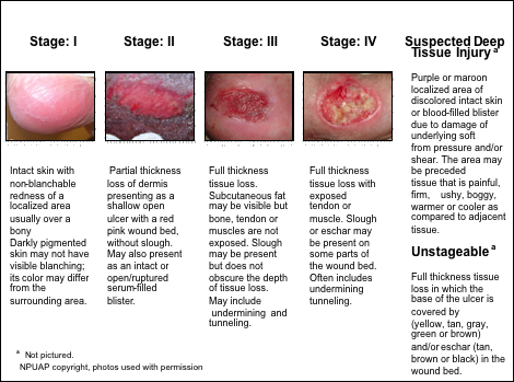 woundcare01