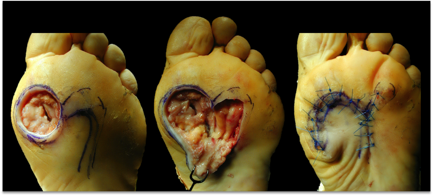 woundcare1