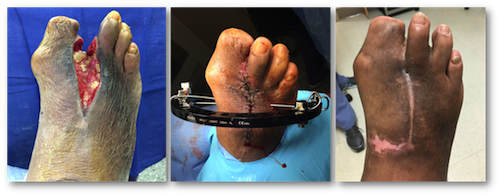 woundcare4